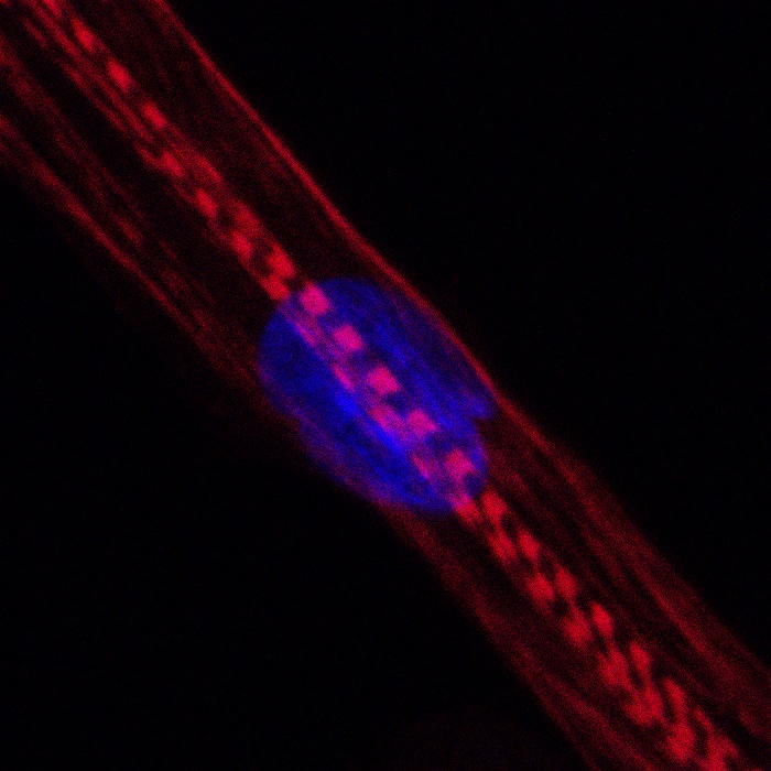 Gestörte Produktion von Myosinen: Diese Proteine sind im Bild rot angefärbt, der Zellkern blau. Die Querstreifen zeigen, dass die Zelle sich in eine reife Muskelfaser entwickelt. (Foto: Andreas Marg, MDC)