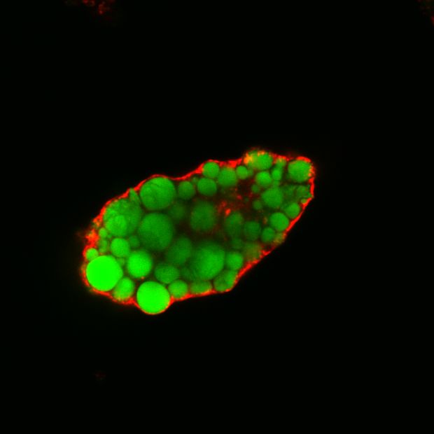 Foto: Lipidtropfen (angefärbt) in einer Fettzelle ohne EHD2. © Claudia Matthäus, MDC