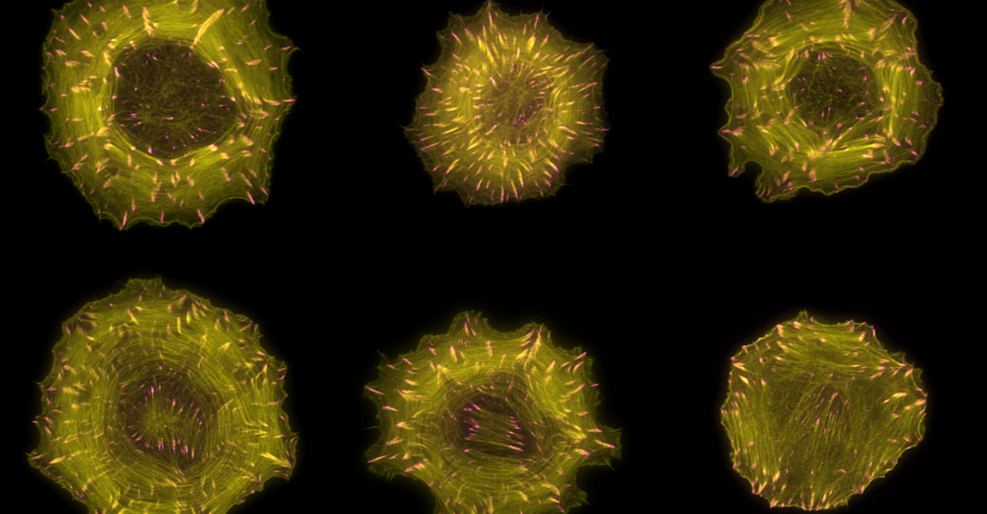 Microscopic images of cells in which filaments of the actin cytoskeleton are labelled in yellow and focal adhesions are labelled in pink. (© Markus Müller, Rocks Lab, MDC)