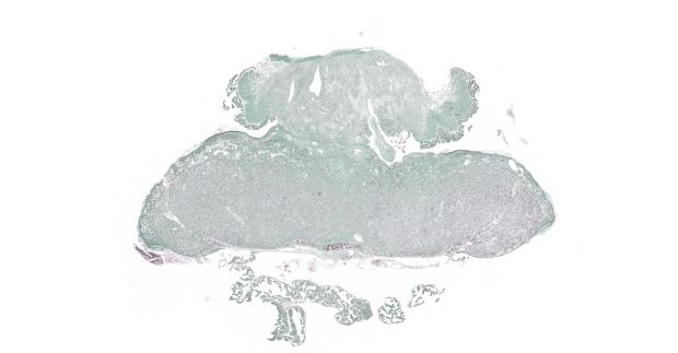 Histologisches Bild einer Rattenplazenta: MDC-Forschende analysierten mit Hilfe dieses Bildes u.a. die Spiralaterien, um Rückschlüsse auf die Versorgung des Fötus zu gewinnen. © Nadine Haase, MDC