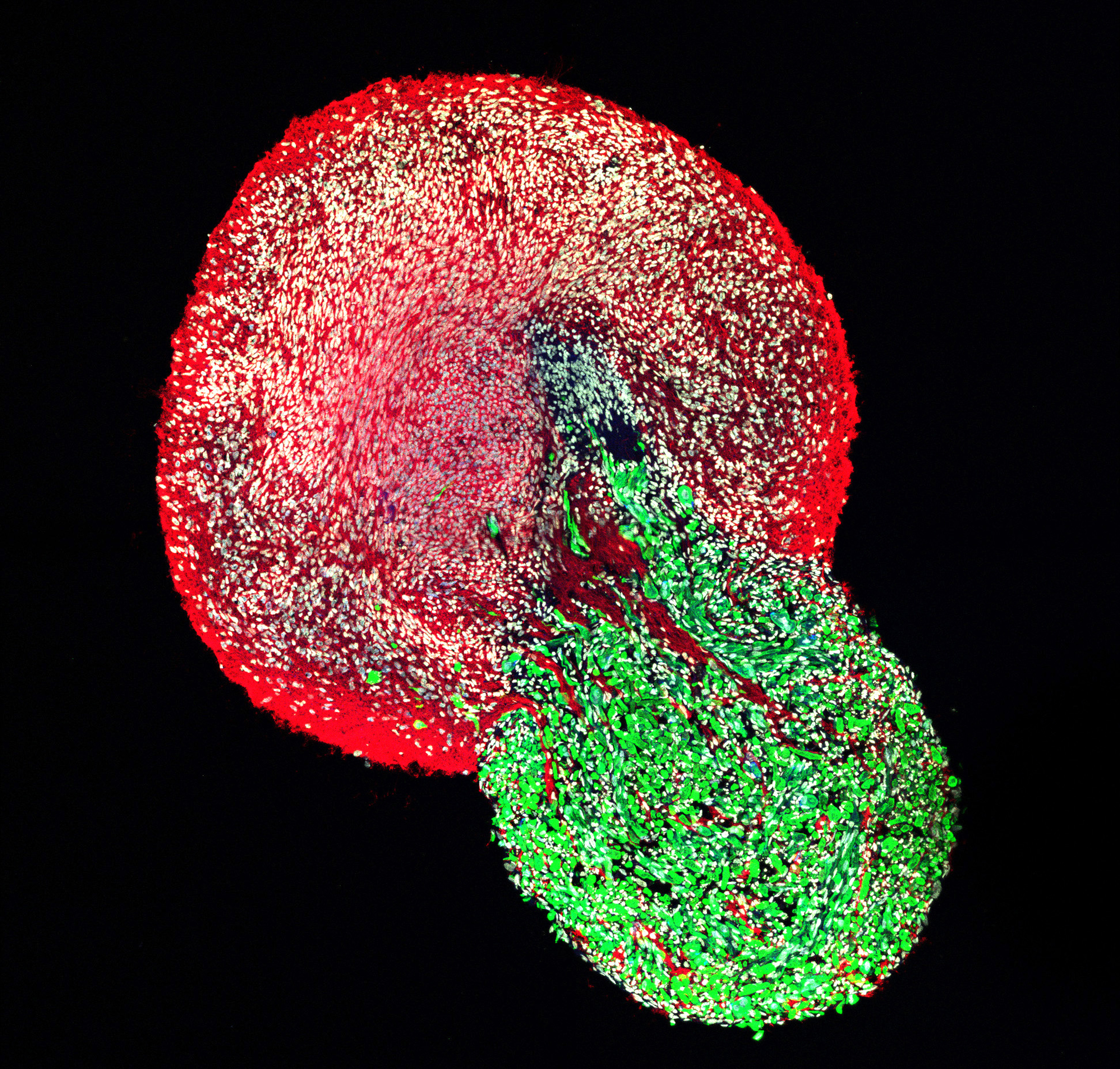 Ein Schnitt durch ein ganzes neuromuskuläres Organoid, bei dem menschliche Rückenmarksneuronen (rot) die Skelettmuskelzellen (grün) anregen. Alle Zellkerne sind weiß angefärbt. Foto: Jorge Miguel Faustino Martins, Gouti Lab, MDC