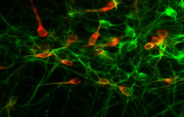 Auf Serotonin reagierende Neuronen (rot) im Gehirn der Maus. (Bild: Natalia Alenina, MDC)
