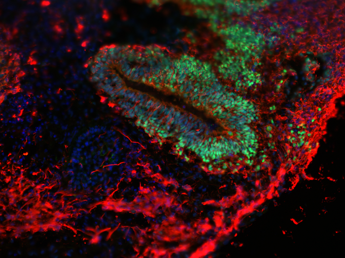 In den Organoiden, in denen die SURF1-Mutation genetisch korrigiert wurde, sind die neurogenen Vorläuferzonen (grün) wiederhergestellt, und es können reife Neuronen (rot) gebildet werden. (© Dr. Rybak-Wolf, Organoide Plattform, MDC)