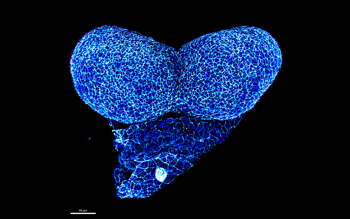 Vordere Neuralfalten in einem Mausembryo. Foto: AG Hammes, MDC  Morphologische Veränderungen der Neuralfalten der Maus während der Neuralrohrbildung (Foto: AG Hammes, MDC)