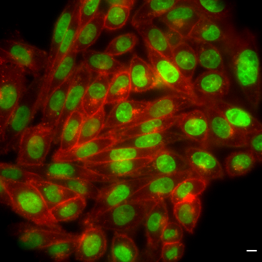 Live cell imaging of native cell surface receptors (here GLP1R in red) in living cells (nucleus in green, scale bar = 5 micrometer). Author: Johannes Broichhagen and Ramona Birke