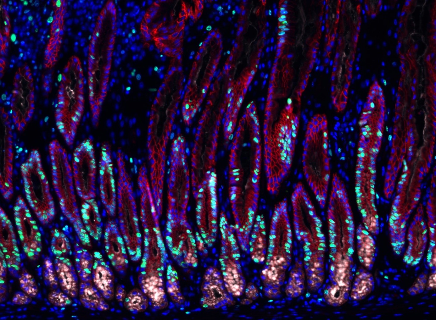 Mit Helicobacter-Bakterien infiziertes Magengewebe. Sich teilende Zellen sind grün, Zellkerne blau dargestellt. © Charité / Michael Sigal