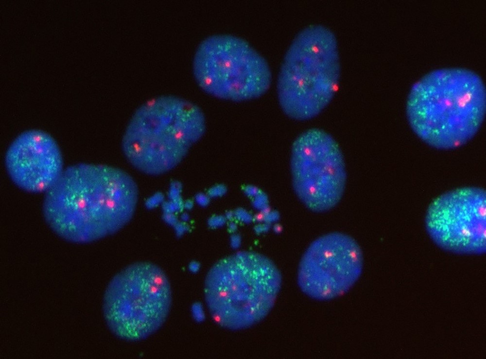 Circular DNA: fluorescently labeled ecDNA (green) in tumor cell nuclei (blue). © AG Henssen, MDC