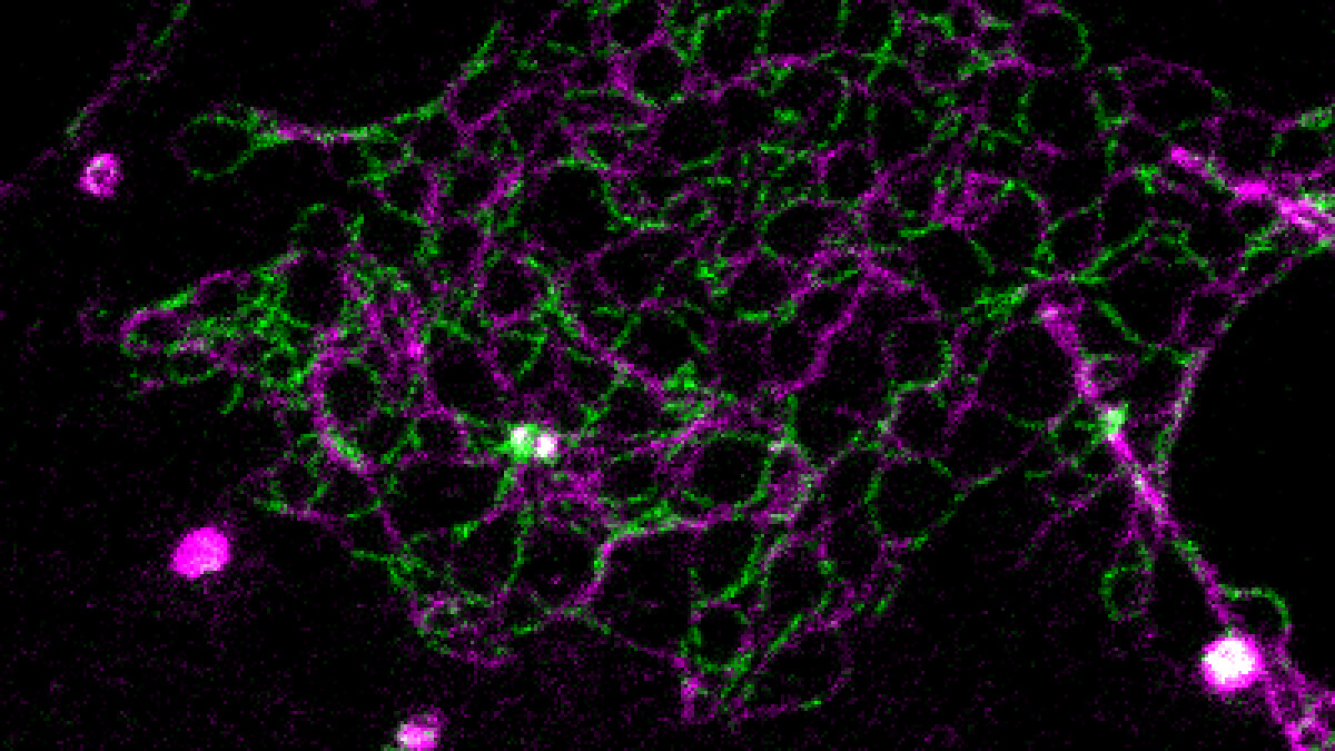 Nano-Netzwerke von segregierenden Claudin 2 (gelb) und Claudin 10 (mangenta) wurden mittels STED Mikroskopie mit 20 nm Pixelgrösse aufgelöst (Bild: FMP)