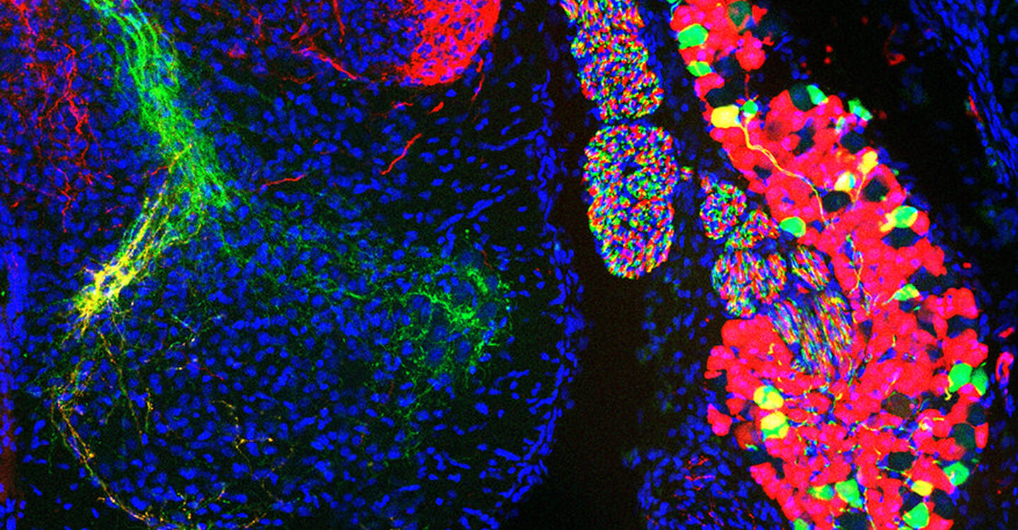 Zellpopulationen von sensorischen Neuronen in einem Spinalganglion des Rückenmarks (rechts) und ihre Axone im Rückenmark (links) © Stephan Dietrich, AG Zampieri, Max Delbrück Center
