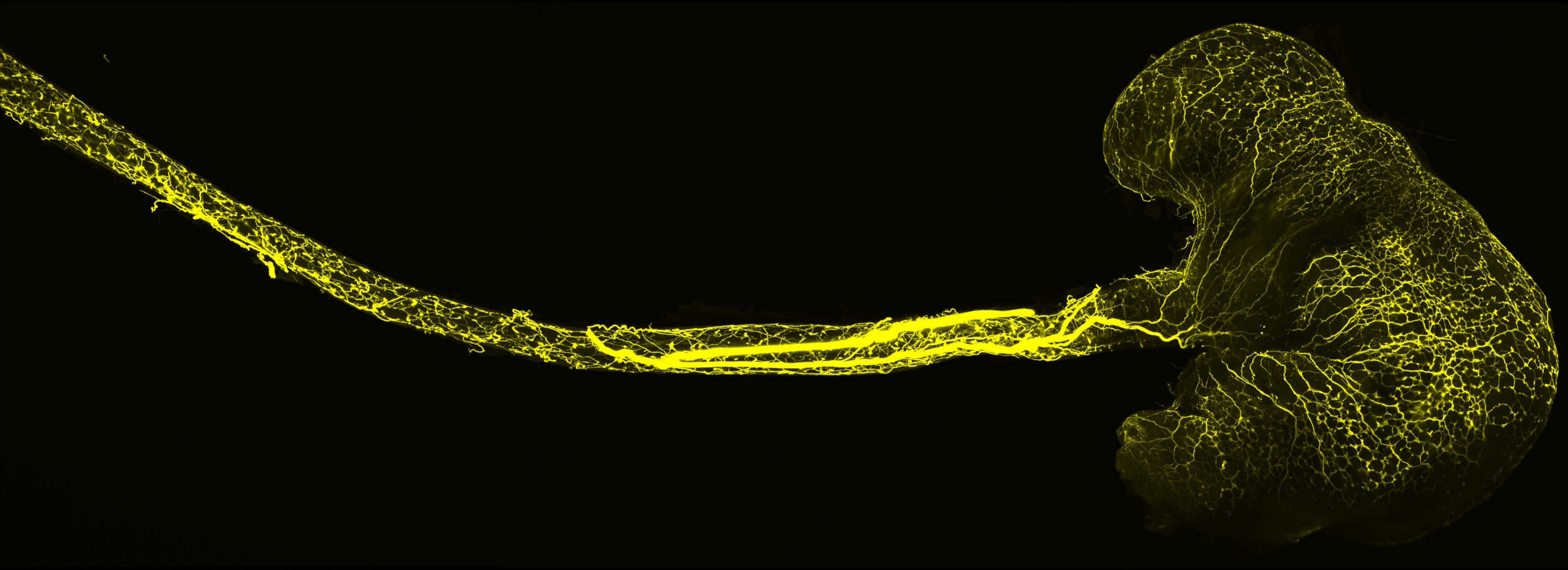Fortsätze der sensorischen Neuronen, die zu einem Nervenzellknoten des Vagusnervs gehören (Foto: Elijah D. Lowenstein, AG C. Birchmeier, Max Delbrück Center)