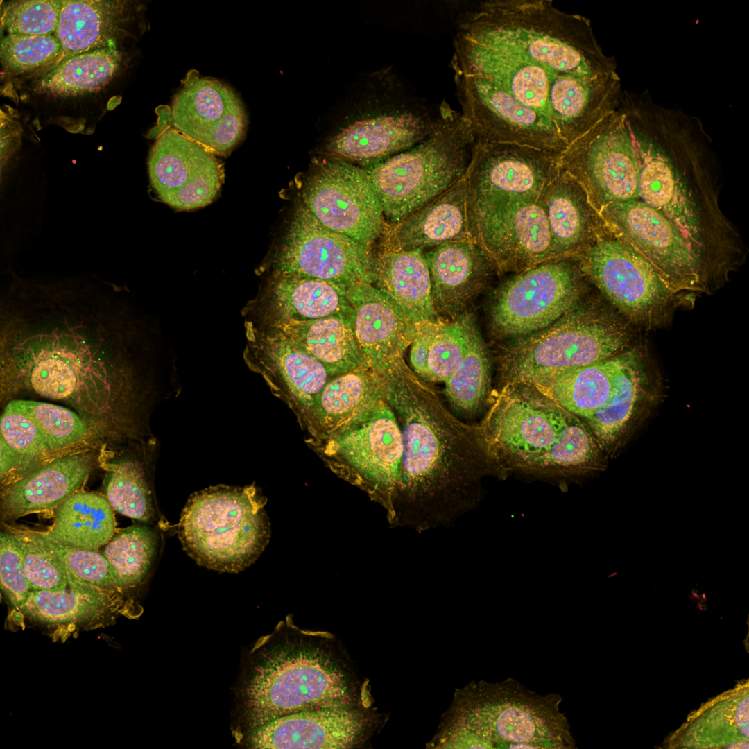 Grundlagenforschung für die Medizin von morgen: Mit Fluoreszenz markierte Zellkerne (Abb. AG von Kries, FMP)