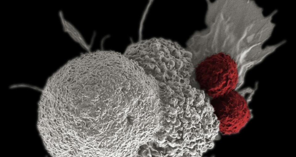 © Rita Elena Serda, National Institutes of Health , CC By-NC-2.0