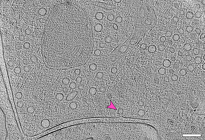 © Jana Kroll Charité/Max Delbrück Center