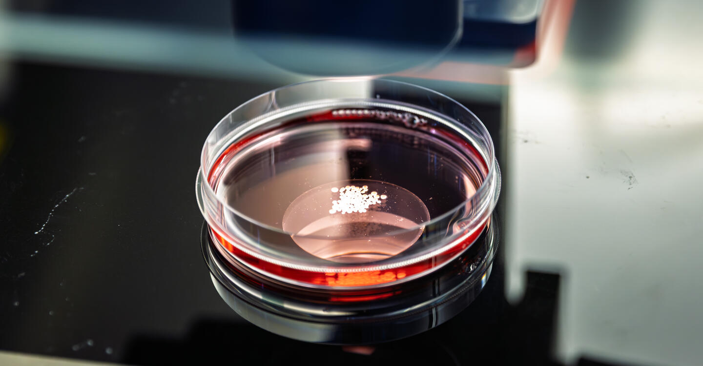Organoide in der Petrischale (Foto: Gouti-Lab, Diecke TP, Felix Petermann/Max Delbrück Center)