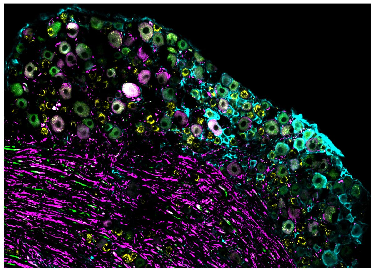 © Phillip Bokiniec, Whitmire lab, Queensland Brain Institute, The University of Queensland